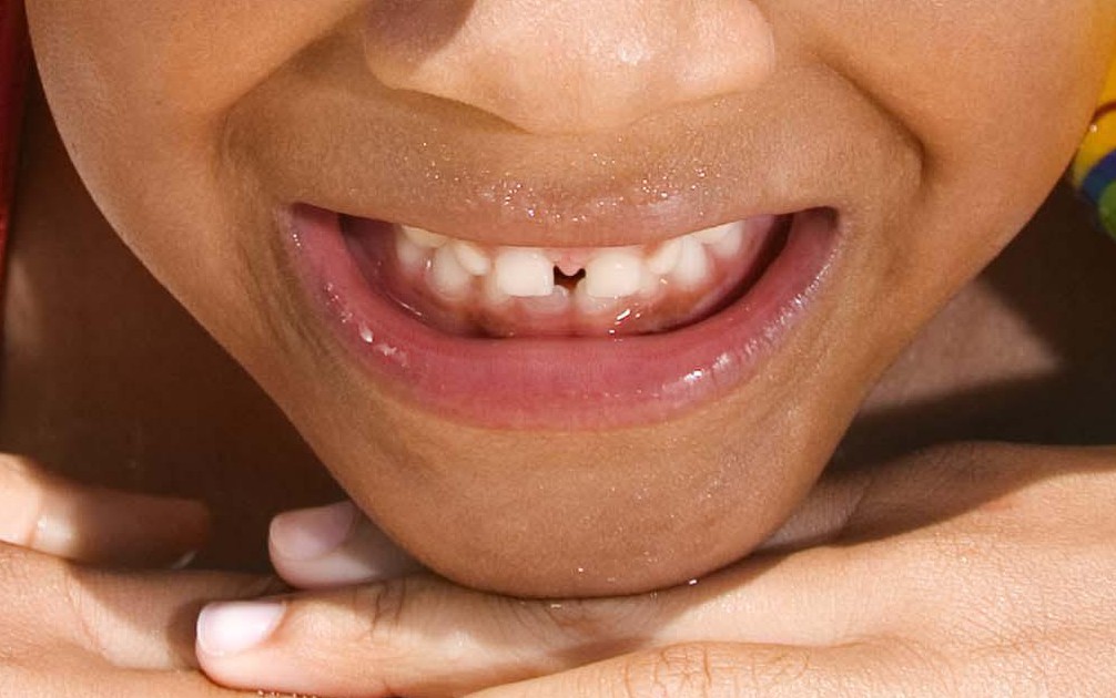 Girl with floaties and goggles in swimming pool